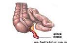 中国康网 回盲部恶性肿瘤
